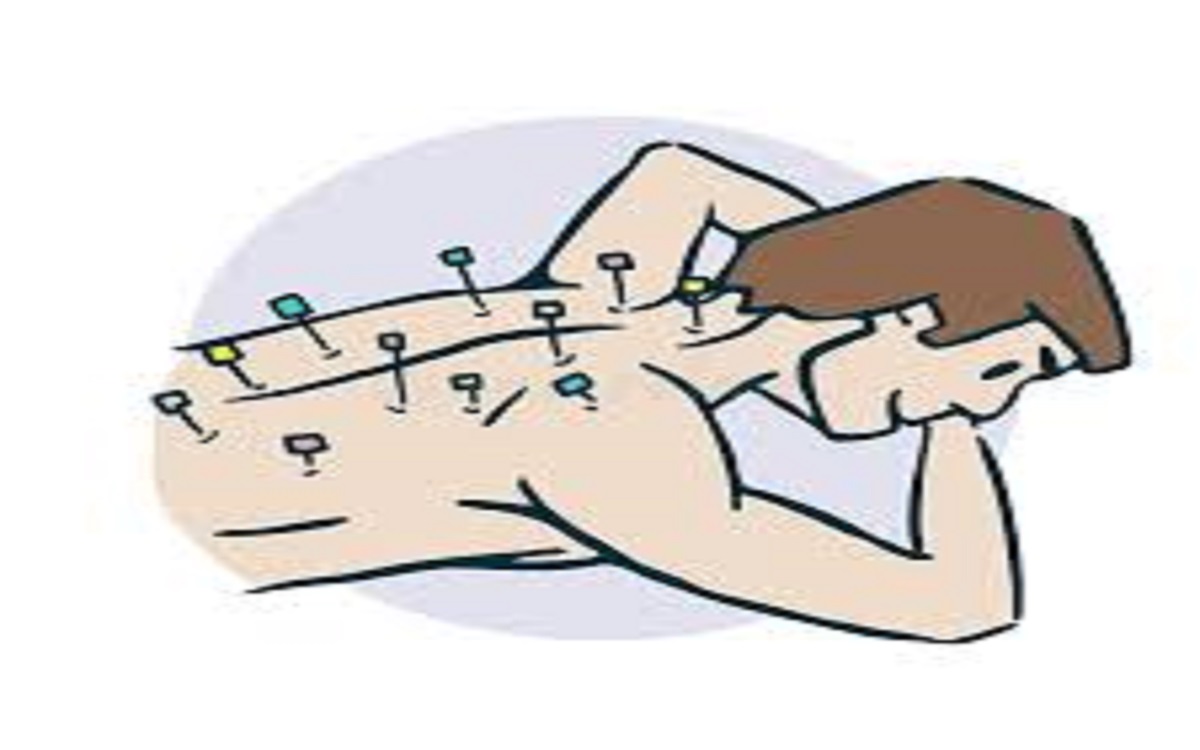 Accupuncture